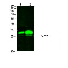 Anti-KCTD7 antibody