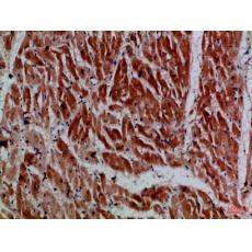 Anti-MYH6/MYH7 antibody