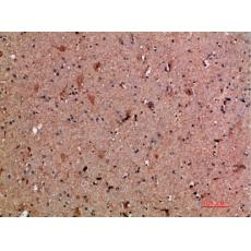 Anti-NNT-1 antibody