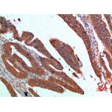 Anti-PDGF-C antibody