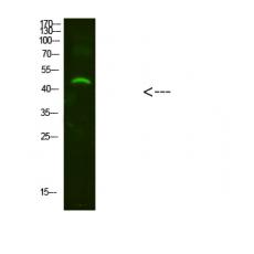 Anti-NMUR2 antibody