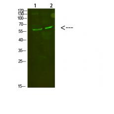 Anti-C8 α antibody