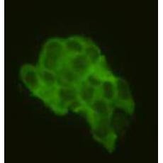 Anti-CD79a antibody