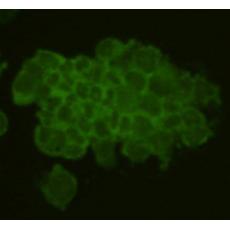 Anti-Rem2 antibody