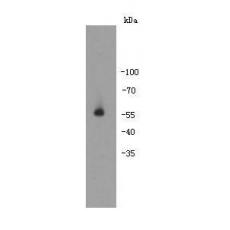 Anti-Autoimmune regulator (AIRE) antibody