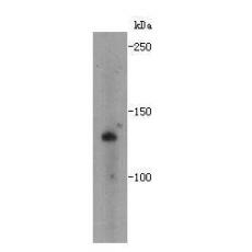 Anti-ZFX antibody