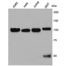 Anti-Nucleolin antibody