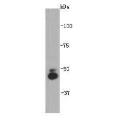 Anti-IRX2 antibody