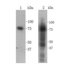 Anti-Transferrin antibody