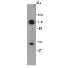 Anti-VEGFC antibody