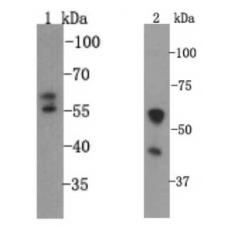 Anti-VMAT1 antibody