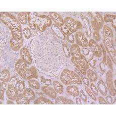 Anti-PTPRF/LAR antibody
