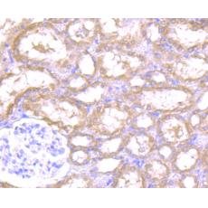 Anti-Rem2 antibody