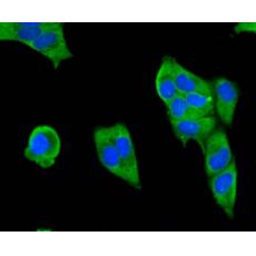 Anti-SMAD3 antibody