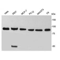 Anti-TBX3 antibody