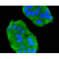 Anti-FPR2 antibody