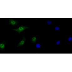 Anti-Tet1 antibody