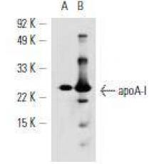 Anti-Apolipoprotein A1 antibody