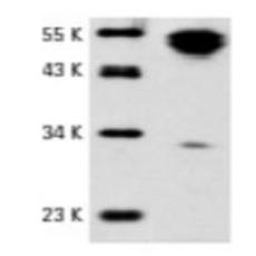 Anti-CD95 / Fas antibody