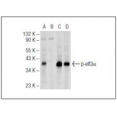 Anti-Phospho-eIF-2a (Ser 52) antibody