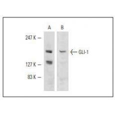 Anti-Gli1 antibody