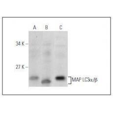 Anti-LC3A/B antibody