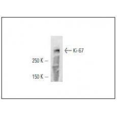 Anti-Ki67 antibody