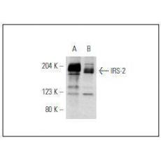 Anti-IRS-2 antibody