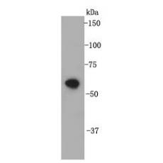 Anti-FGFR2/CD332 antibody