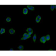 Anti-Cytokeratin 7 antibody