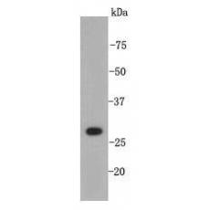 Anti-XBP1 antibody