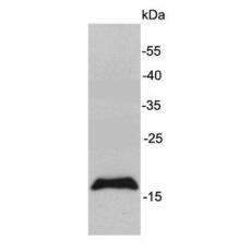 Anti-MAL antibody