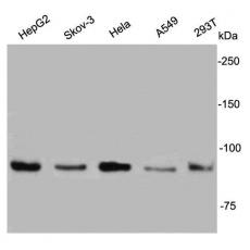 Anti-IGF1R antibody