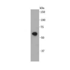 Anti-CHFR antibody