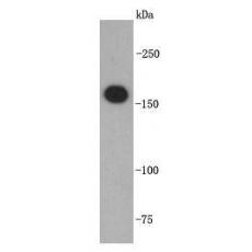 Anti-TOP2A antibody