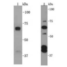 Anti-SQSTM1 antibody