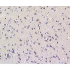 Anti-TESPA1 antibody