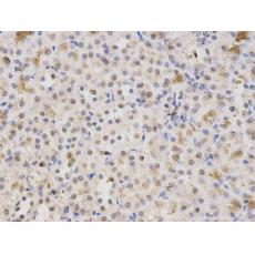 Anti-HMGB1 antibody
