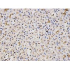 Anti-HMGB1 antibody