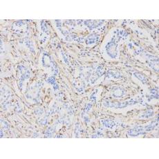 Anti-Vimentin antibody