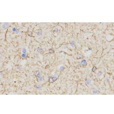Anti-GFAP antibody