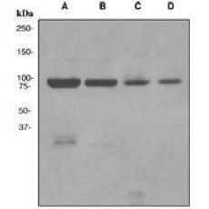 Anti-MLH1 antibody