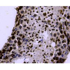Anti-Di-mehtyl-Histone H3(Lys4) antibody