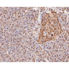 Anti-Mono-mehtyl-Histone H3(Lys4) antibody