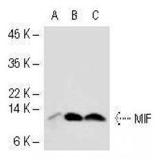 Anti-MIF antibody