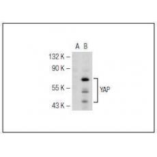 Anti-YAP65 antibody