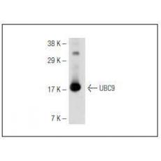 Anti-UBC9 antibody