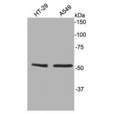 Anti-TFCP2L1 antibody