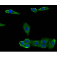 Anti-CCL3 antibody