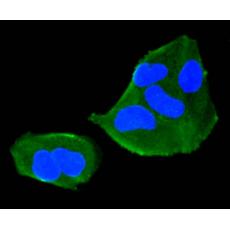 Anti-TMEM39a antibody